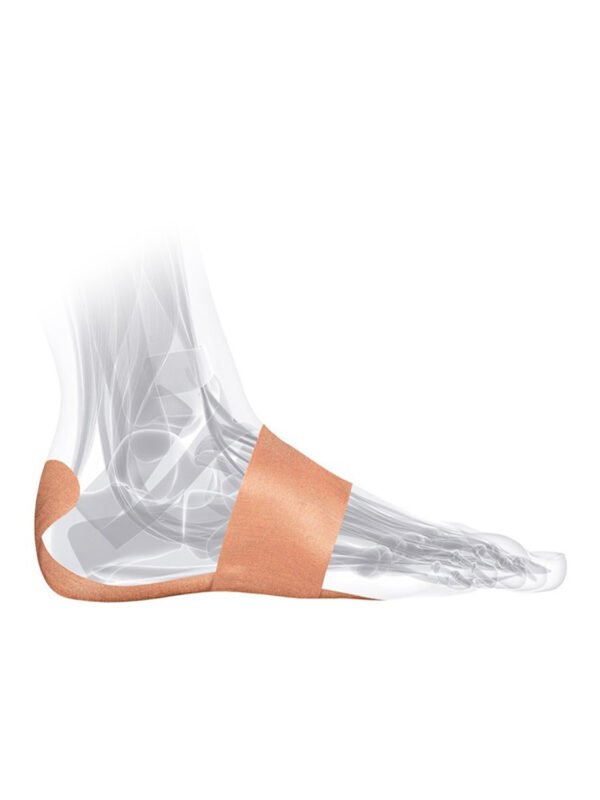 Mueller PFTape Systems - Plantar Fasciitis 7 Strips_3 Mueller PFTape Systems - Plantar Fasciitis (7 Strips)