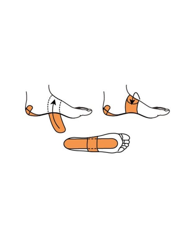 Mueller PFTape Systems - Plantar Fasciitis 7 Strips_6 Mueller PFTape Systems - Plantar Fasciitis (7 Strips)